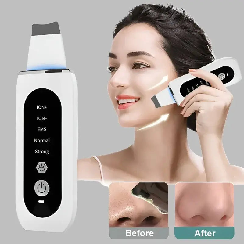 Ultrasonic Skin Peeling Blackhead Remover Deep Face Acne Pore Facial Cleanser