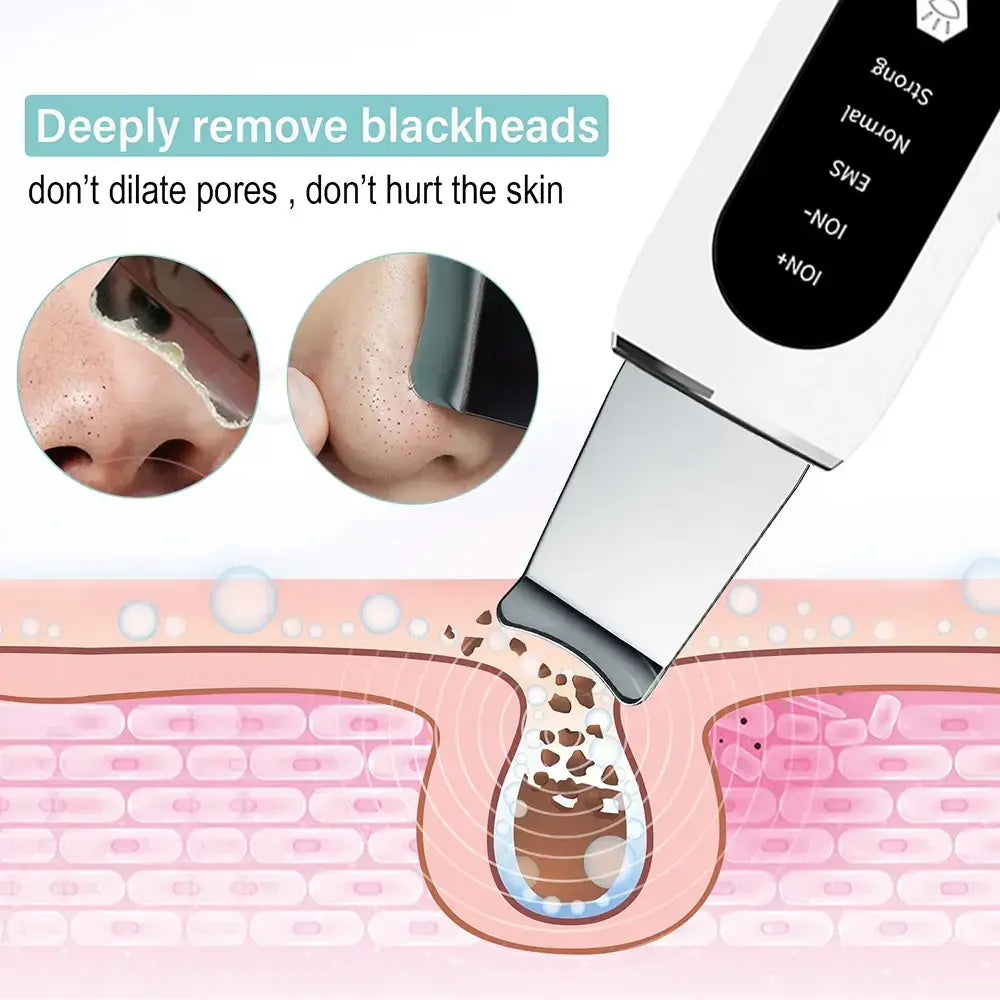 Ultrasonic Skin Peeling Blackhead Remover Deep Face Acne Pore Facial Cleanser